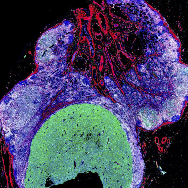 Generic placeholder image